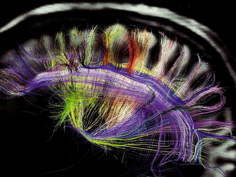 Brain Scan 5, neurons, mri, ry, brain, axons, HD wallpaper