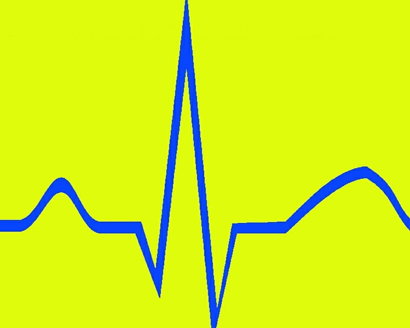 Blue EKG Yellow, yellow, corazones, heartbeat, gizzzi, frenchcore, heart,  beat, HD wallpaper | Peakpx