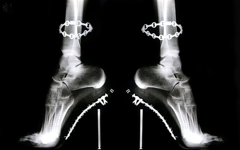Cruel Shoes 001, black and white, not walking shoes, stilettos, entropy, x ray foot, HD wallpaper