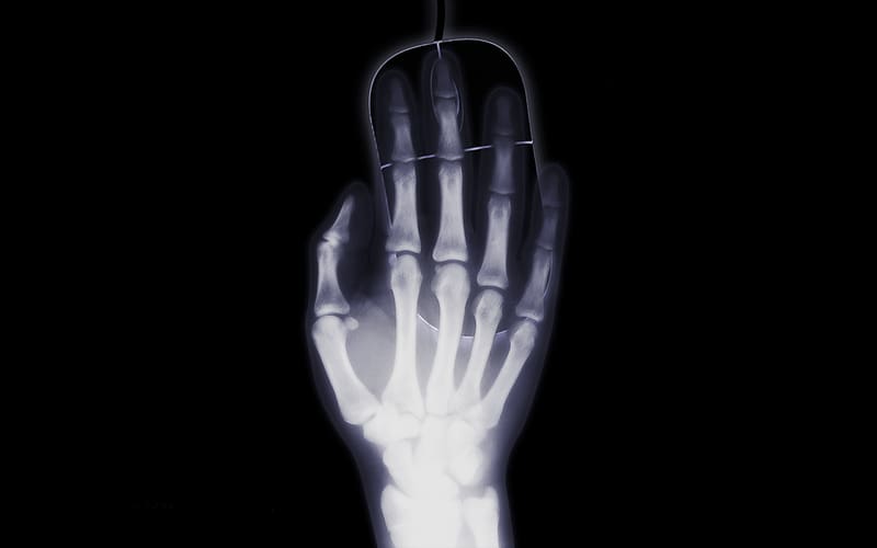 Hand, X Ray, , Bones, Humor, Minimalist, Mouse (Peripheral), X Ray Vision, HD wallpaper