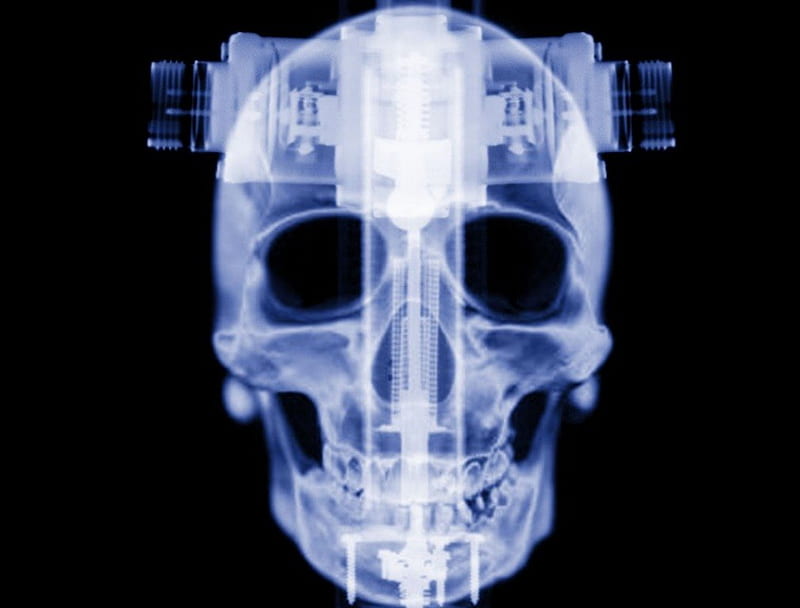 Techno-x-ray, x ray, skull, HD wallpaper