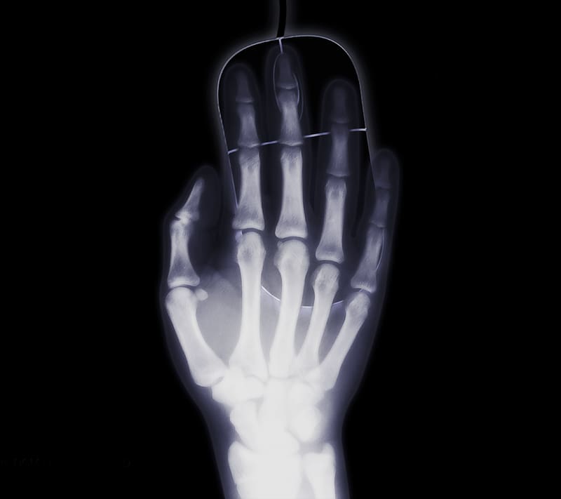 Hand, X Ray, , Bones, Humor, Minimalist, HD wallpaper