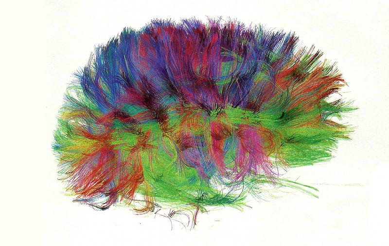 Brain Scan 5, scan, nerves, circuitry, wide screen, ry, brain, axons, HD wallpaper