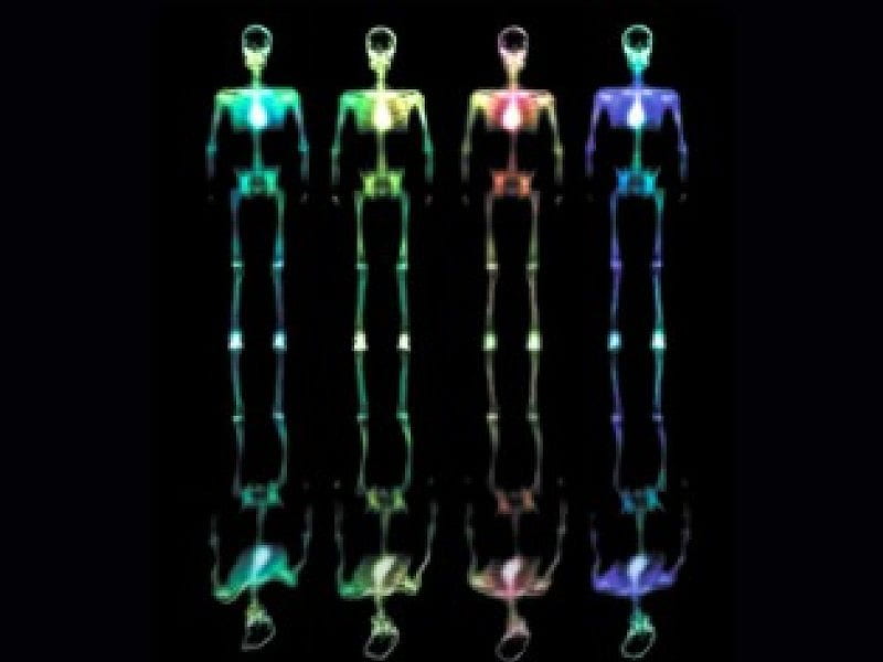Four Rainbow Skeletons, four, colored, rainbow, sketetons, x-ray, HD wallpaper