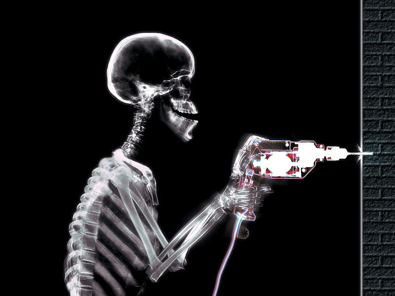 X-ray Drilling, drill, skeleton, drilling, skull, x-ray, HD wallpaper |  Peakpx