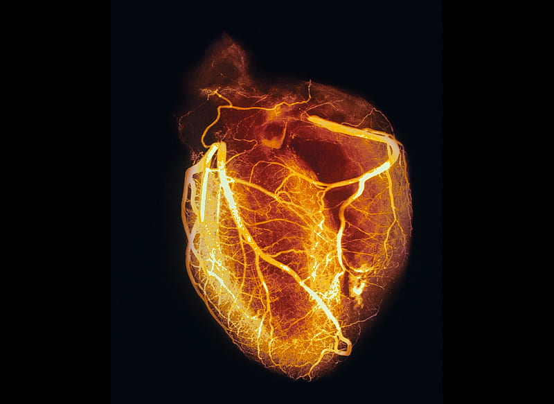 heart x ray gif, Human Heart, HD wallpaper