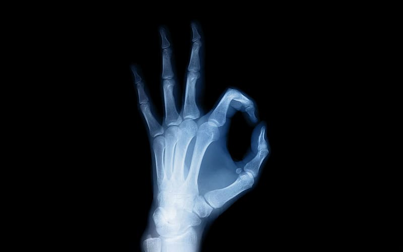 Hand, X Ray, , Anatomy, X Ray Vision, HD wallpaper