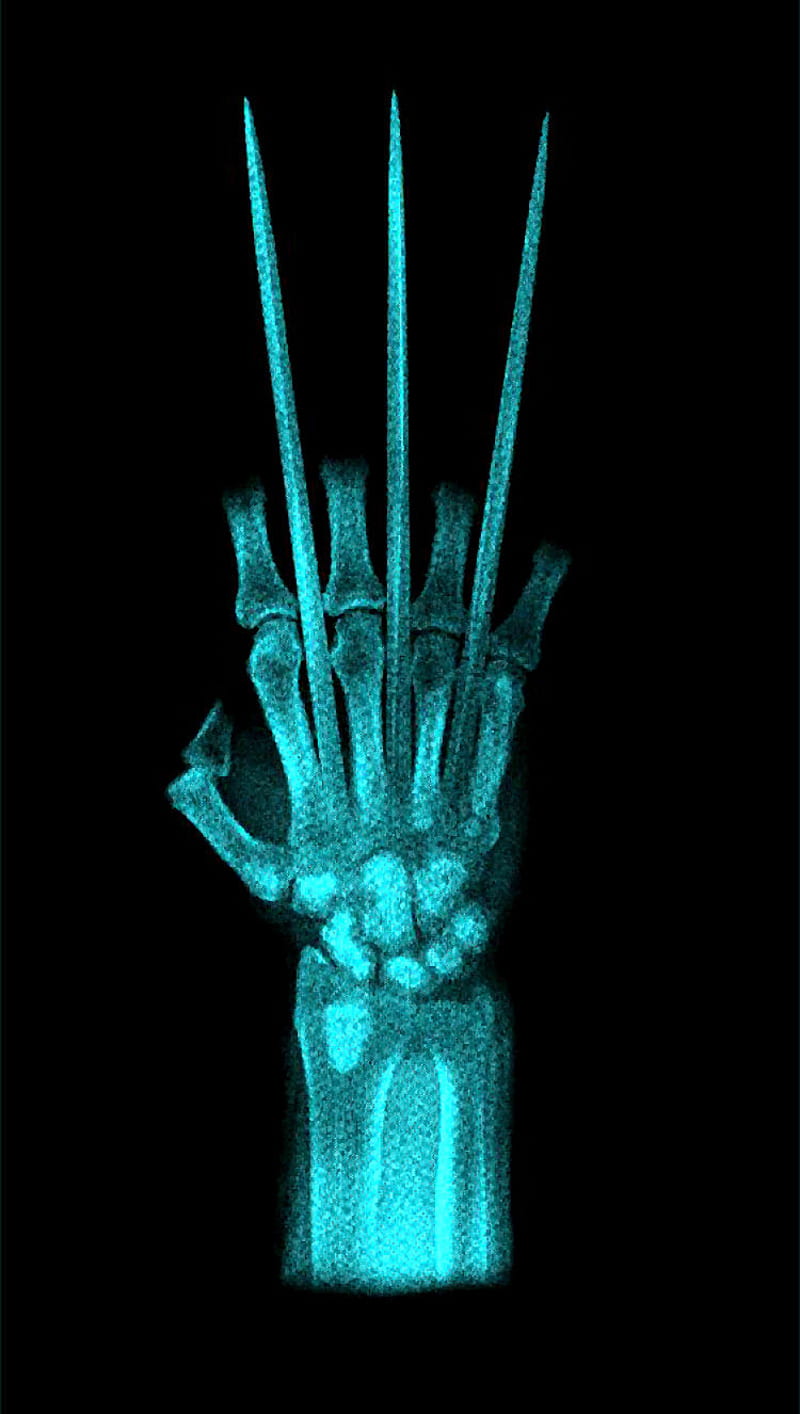 Wolverine Claw X-Ray, claws, comic, comics, dc, marvel, men, x-me, xmen, HD phone wallpaper