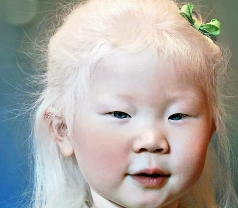 Albino Girl, Girl, bonito, Albino, Children, HD wallpaper