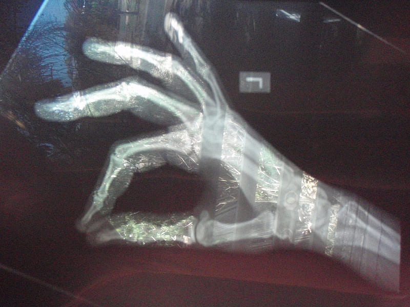 X ray of hand, doctor, graphy, hand, x ray, fingers, bones, HD wallpaper