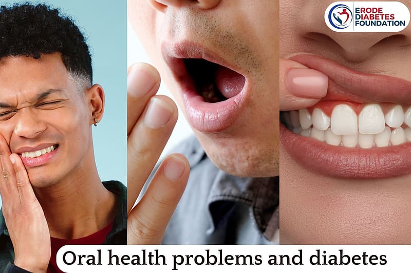 Oral health problems and diabetes-complications and remedies, bestdiabetictreatmentinerodediabetesfoundation, famousdiabetictreatmentinerode, bestdiabetologistinerode, bestdiabetictreatmenterode, erodediabeticfoundation, Snacksfordiabeticpatients, bestdiabeticserviceserode, Indiandiabeticfoodlist, bestdiabetichospitalinerode, Candiabeticpatientseatjaggery, bestdiabeticfoundationinerode, Indiandiabeticdiet, healthysnacksfordiabetics, besttreatmentfordiabetesinerode, Benefitsofcardamom, Benefitsof, famousdiabetichospitalerode, bestdiabeticfoundationerode, Bestcookingoilfordiabeticpatient, HD wallpaper