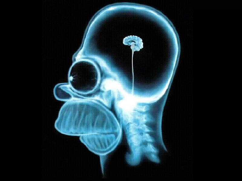 Homers Brain, xray, cool, homer, x-ray, brain, HD wallpaper