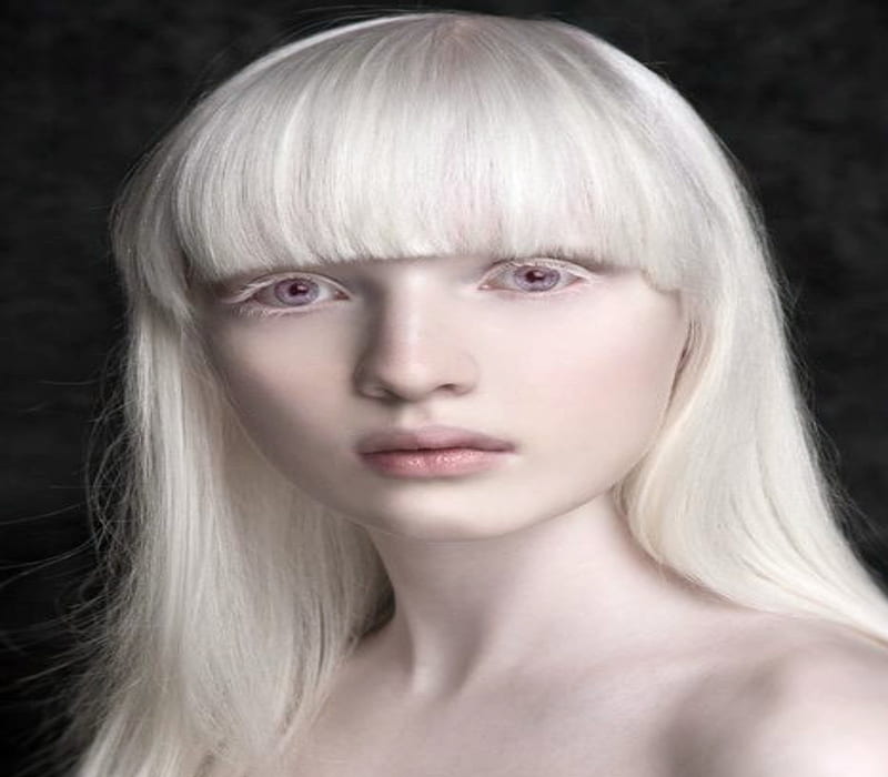 Albino Model, Model, bonito, White, Blue eyes, Albino, HD wallpaper